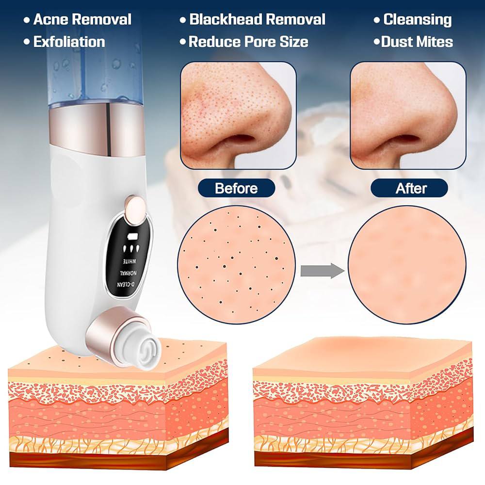 Gloowly™ Remover Pore Vacuum Face
